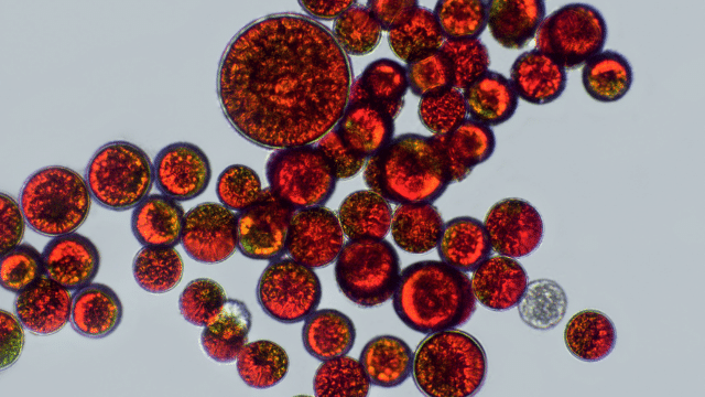 #396 - Astaxanthine et SOPK